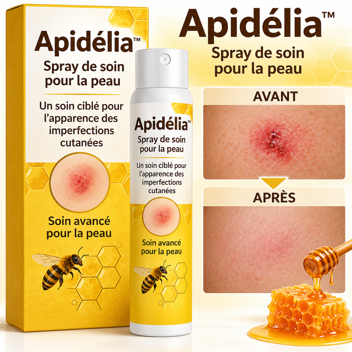 Apidélia™ Spray Peau au Venin d’Abeille | Faites disparaître vos verrues, taches et boutons en 10 minutes !