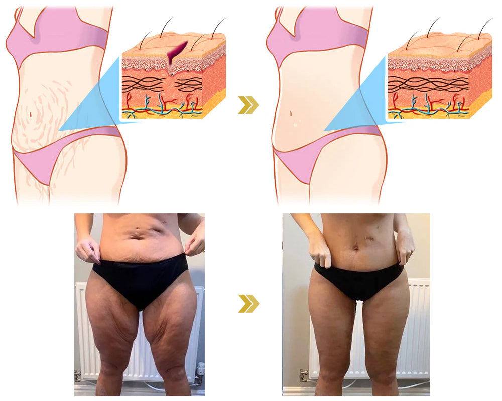 Ceoerty™ Ultra-Firming Bee Venom Cream 8 Ceoerty™ Ultra-Firming Bee Venom Cream