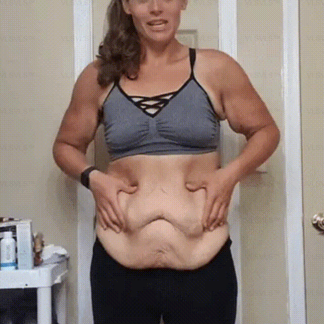 Ceoerty™ Ultra-Firming Bee Venom Cream