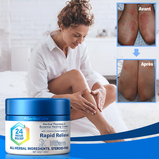 SkinRelief™ Crème Apaisante Intense | Élimine 98 % du psoriasis et de l’eczéma en seulement 5 jours!