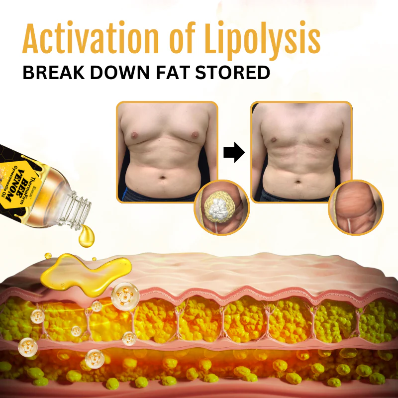 ChestBurn™ Huile Réductrice au Venin d’Abeille | Élimine les seins masculins en 7 jours chrono!