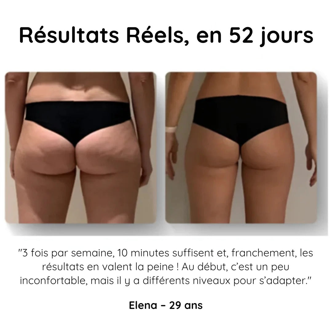HelveTone™ - Masseur Anti-Cellulite