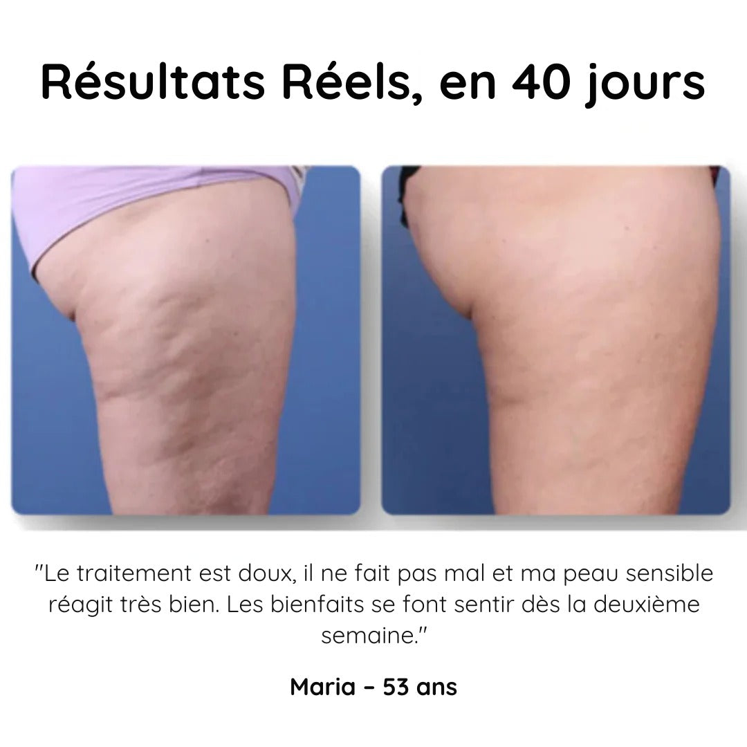 HelveTone™ - Masseur Anti-Cellulite